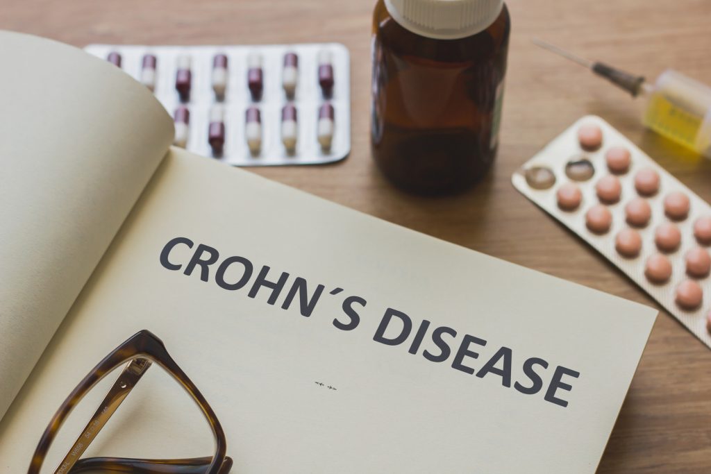 Acupuncture for Crohn’s Disease and Other Digestive Disorders Atlanta